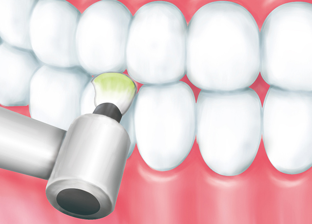 歯の際や溝までくまなく磨き上げます​