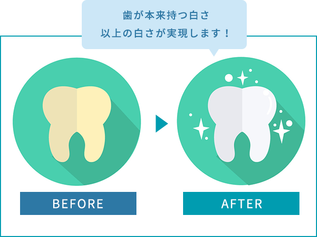 歯が本来持つ白さ以上の白さが実現します！​